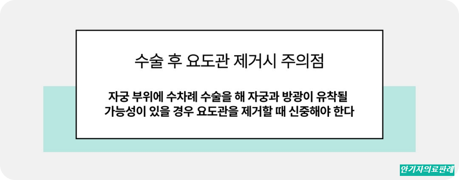 수술 후 요도관 제기할 때 주의점