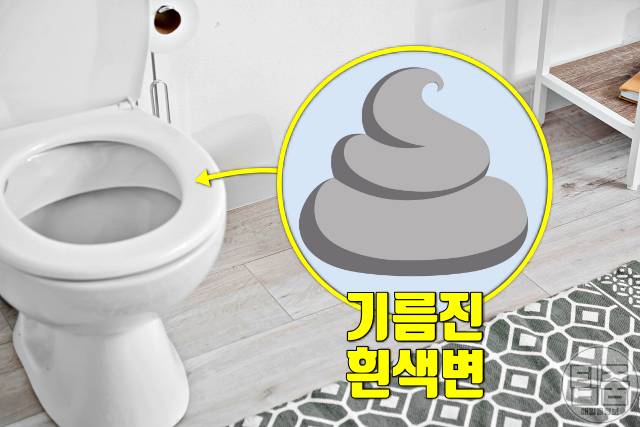 췌장암 의심 증상: 변색;  췌장암 생존율이 낮은 이유