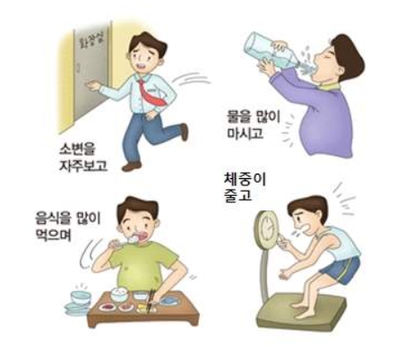 당뇨병의 초기 증상