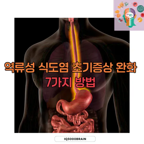 역류성 식도염 초기증상