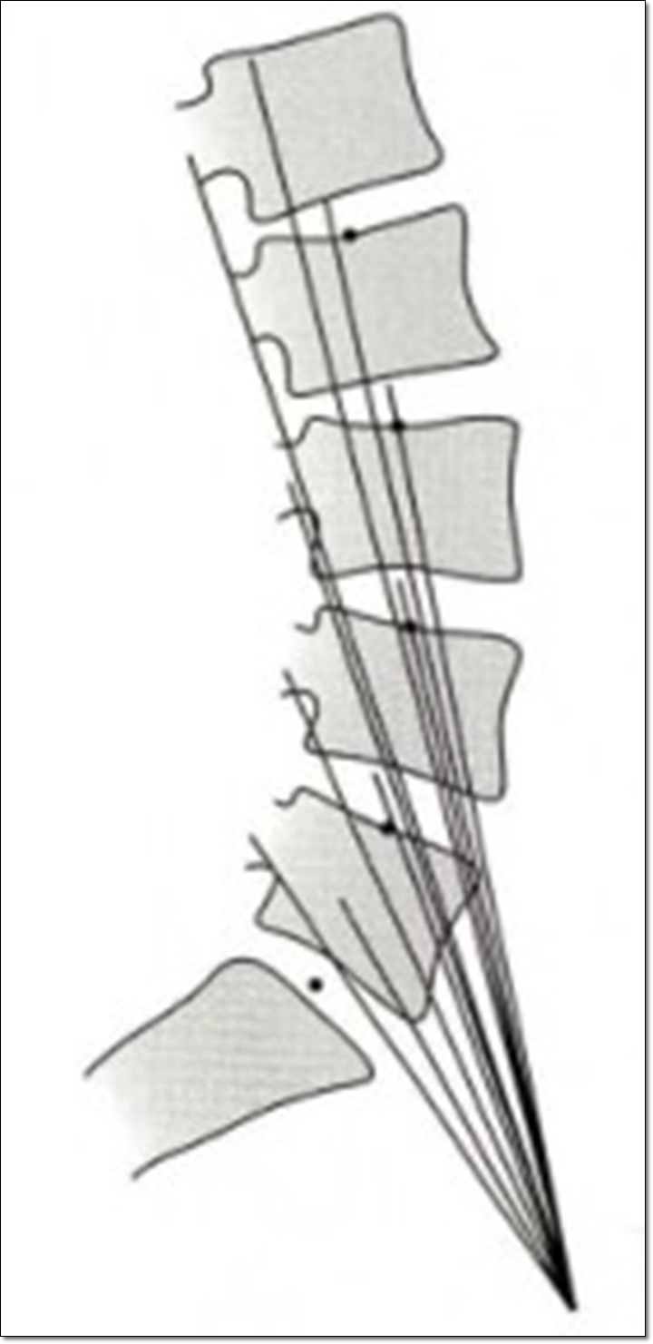 대요근의 근육 방향을 선으로 나타낸 그림