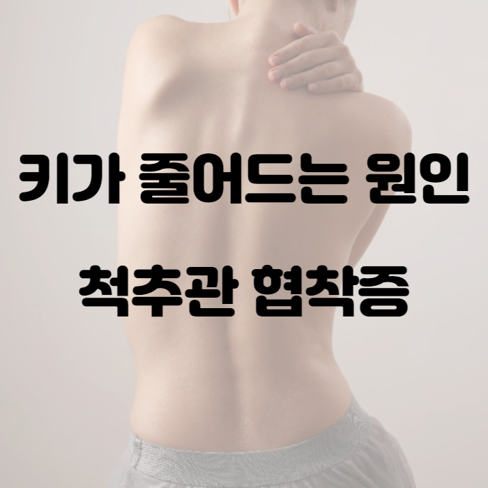 키가 줄어드는 원인 2번째 : 척추관협착증