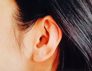 이명 치료