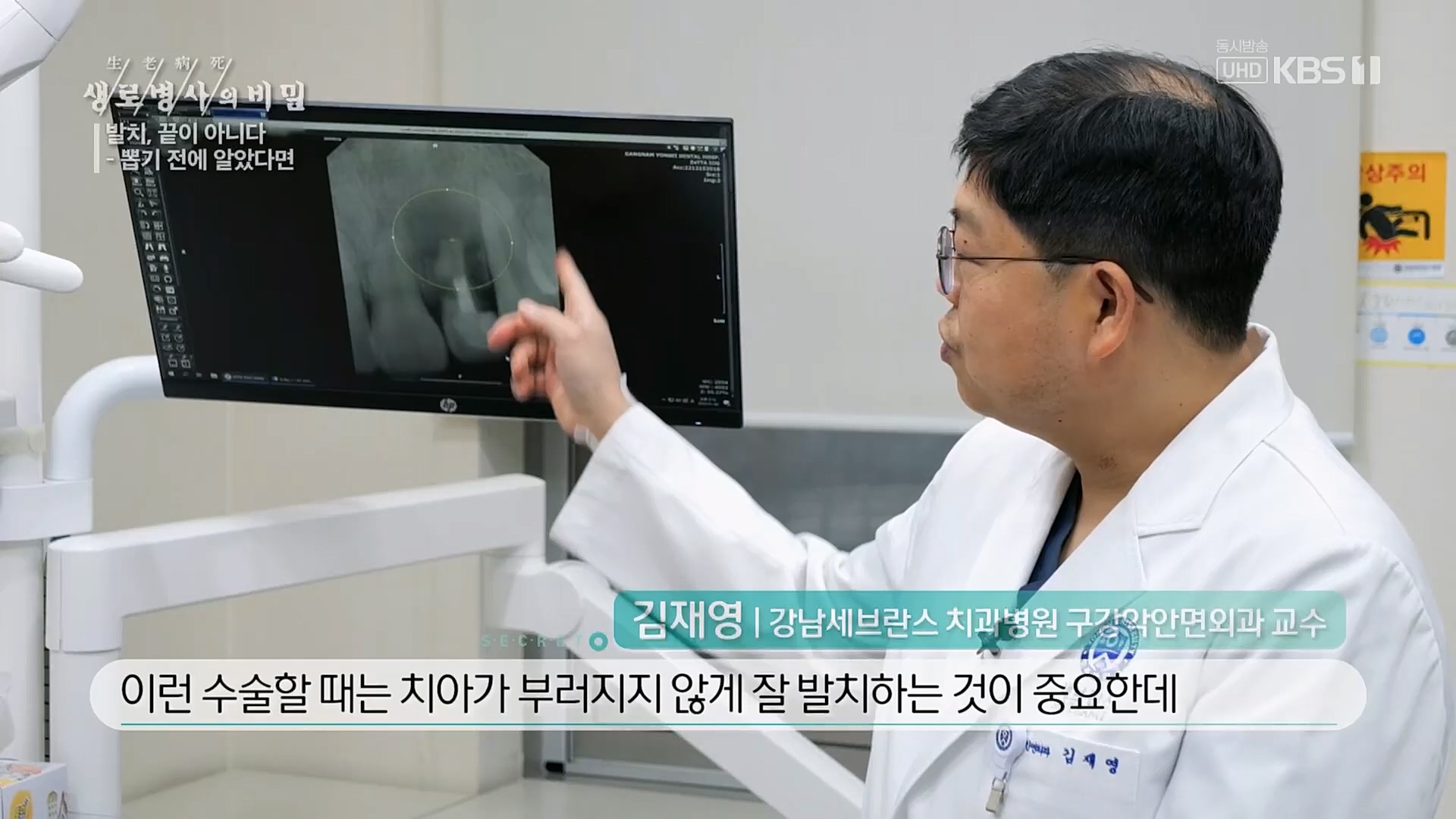 생로병사의 비밀.E855.230208p.H264-F1RST.mp4_20230214_194923.714.jpg