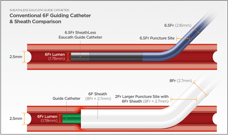  "국내 최초 심장 및 폐 중재시술 가능한 로봇 카테터(Catheters) 시스템 개발" 기계연구원