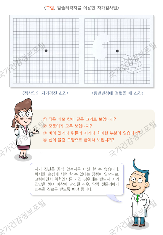 황반변성 검사
