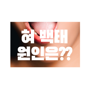  혀 백태 원인은? 백태 제거는 어떻게?