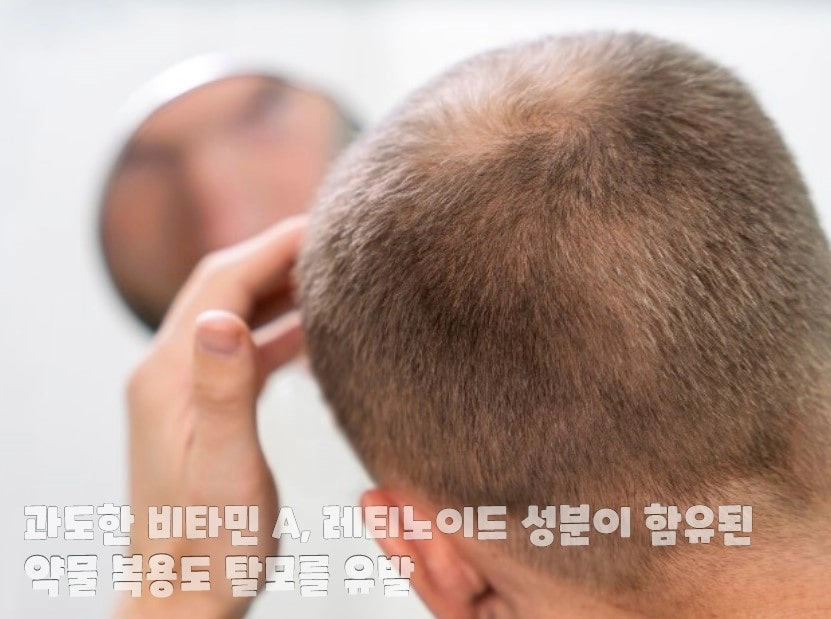 거울을 보며 고민하는 남성의 뒷통수