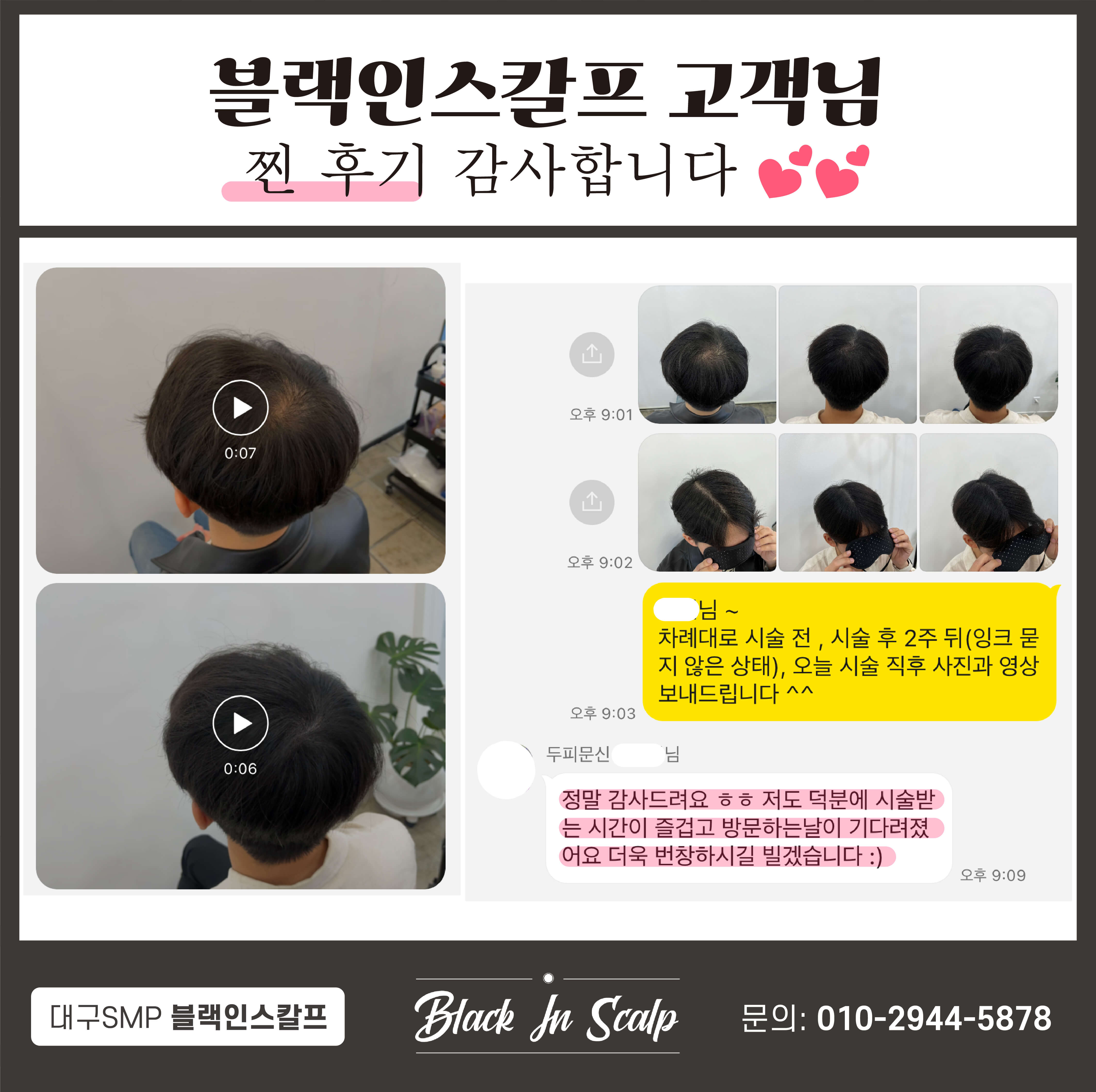 블랙인스칼프 이미지