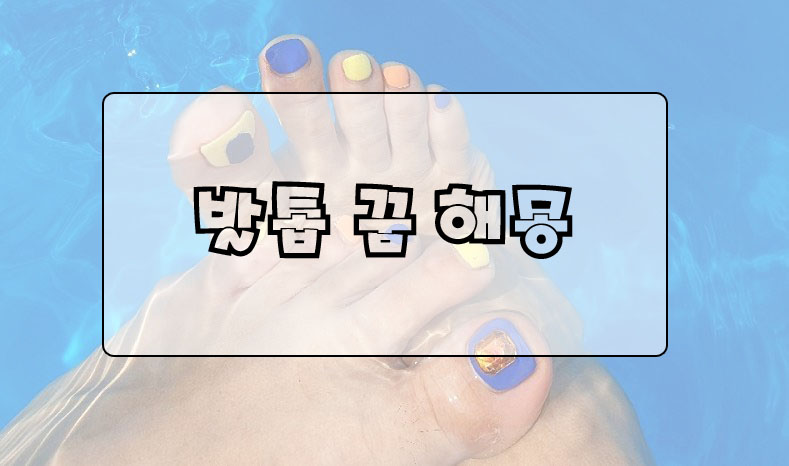  발톱 꿈 해몽