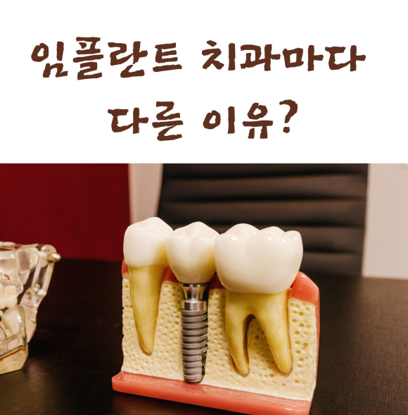 임플란트 치과마다 다른 이유?