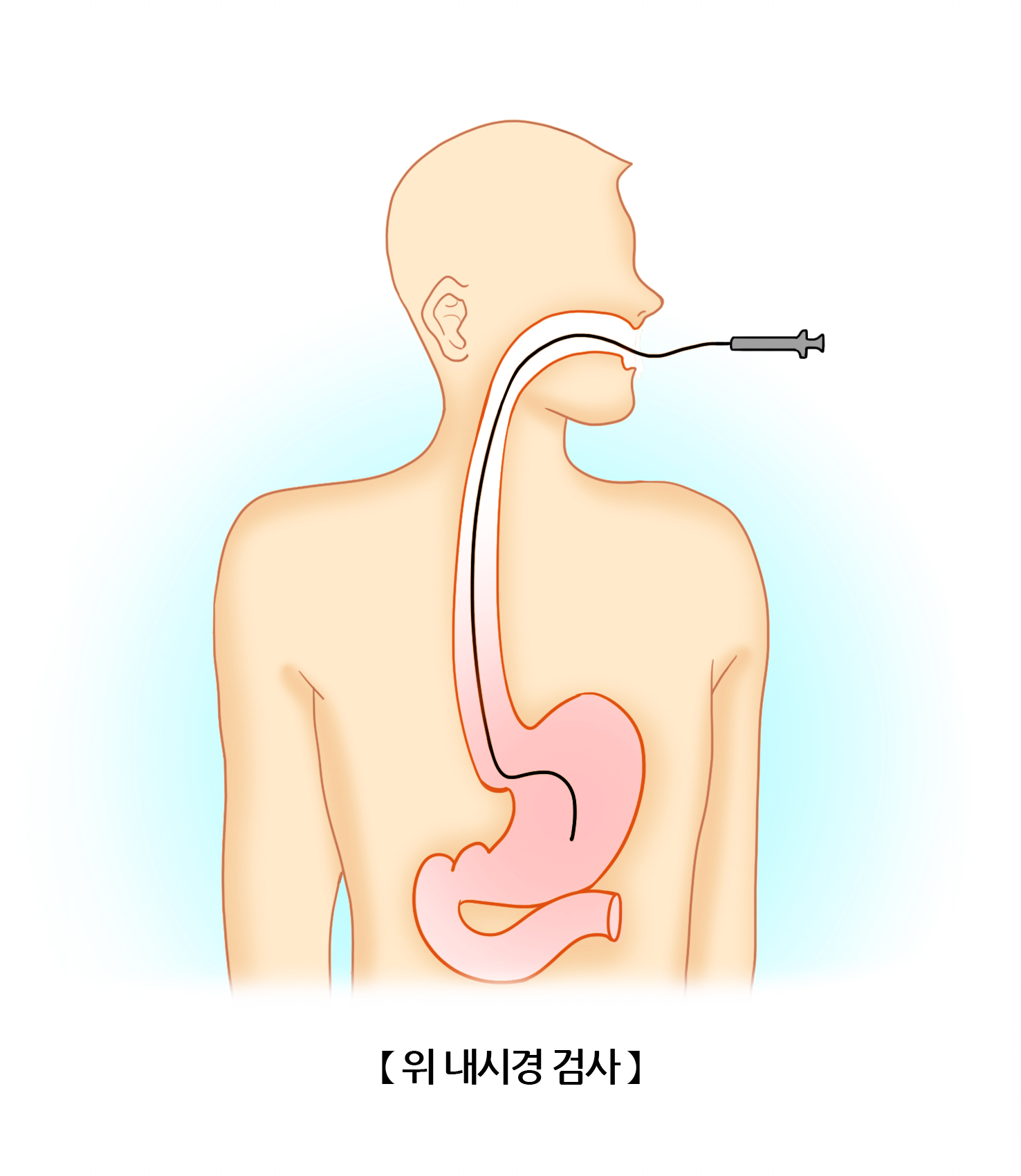 위내시경-금식시간