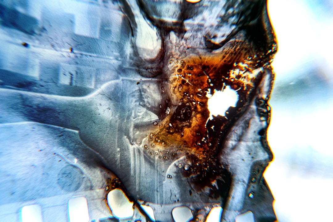 Arthroscopy