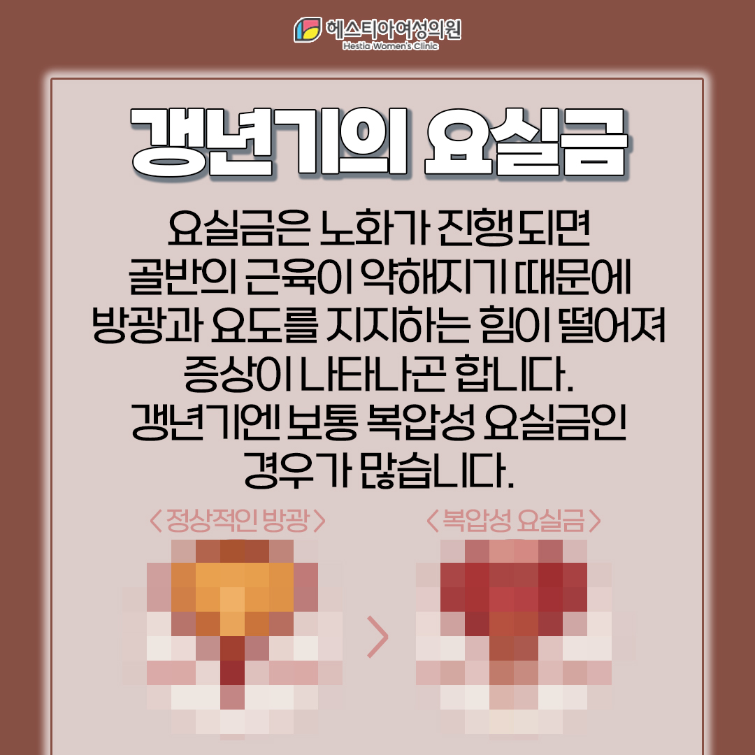 서울요실금수술 갱년기 요실금 복압요실금 갱년기에 찾아오는 요실금