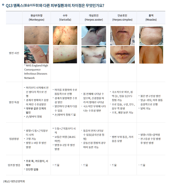 엠폭스와-다른 피부질환과의-차이표