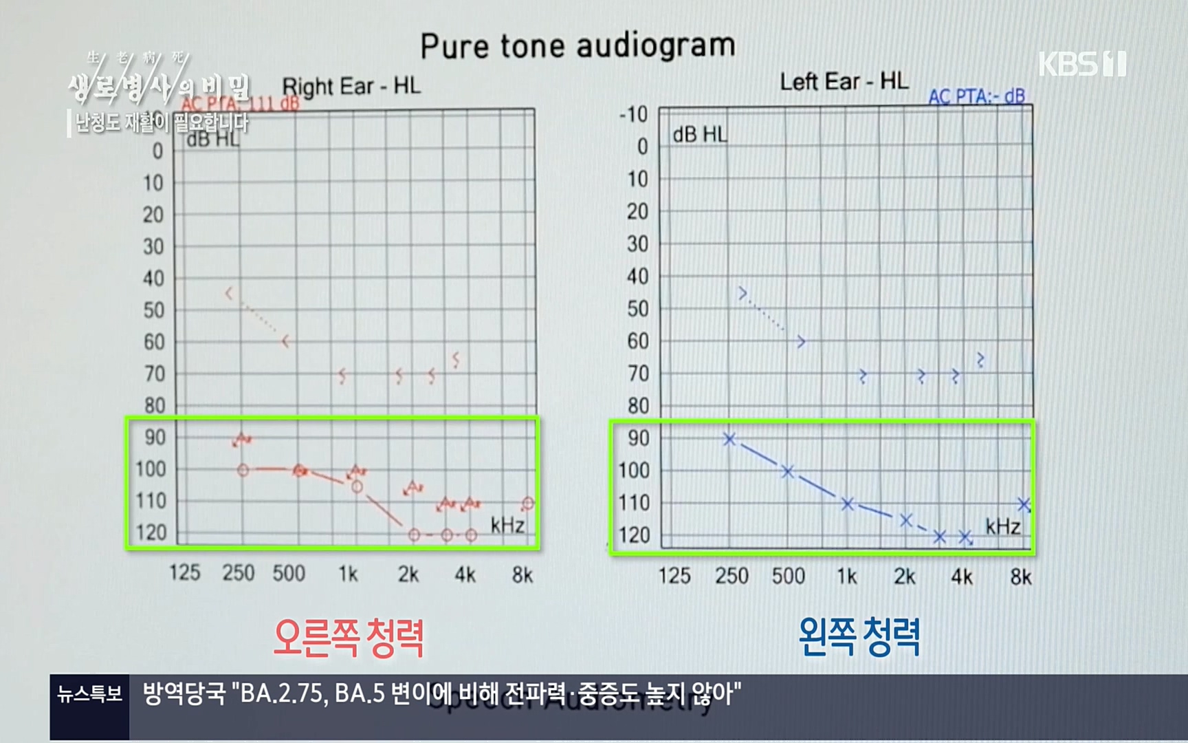 생로병사의 비밀.E837.220928p.H264-F1RST.mp4_20220930_212505.668.jpg