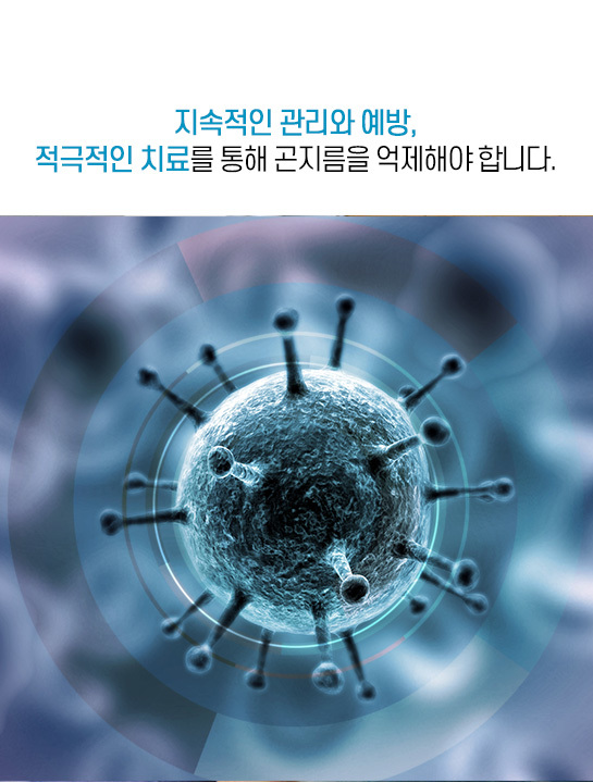  곤지름, 부끄러울 필요도 무서울 필요도 없습니다.