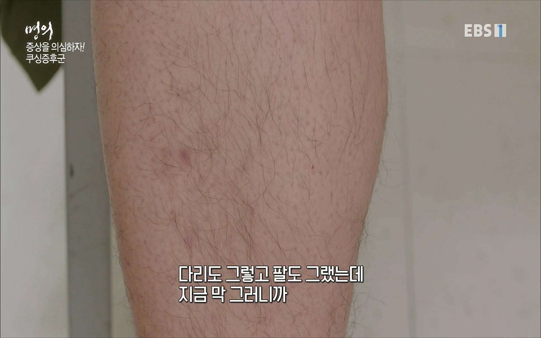 EBS 명의 헬스케어 - TV - 교육의 중심 EBS내 몸을 지배하는 7가지 호르몬 2부, 증상을 의심하자!.mp4_20220711_200211.634.jpg