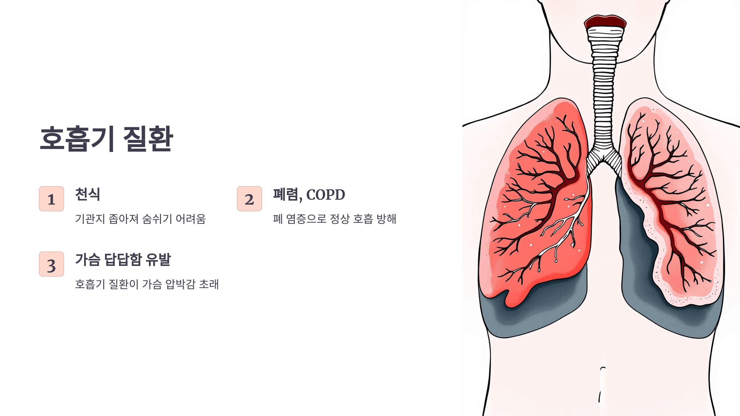 가슴이 답답한 증세