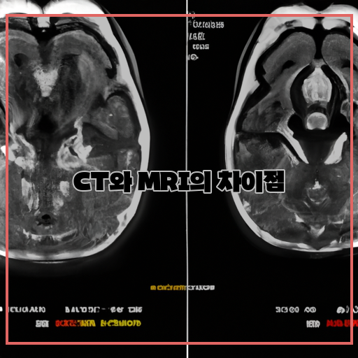 CT-(Computed-Tomography)-MRI-(Magnetic-Resonance-Imaging)-뇌-이미징-(brain-imaging)