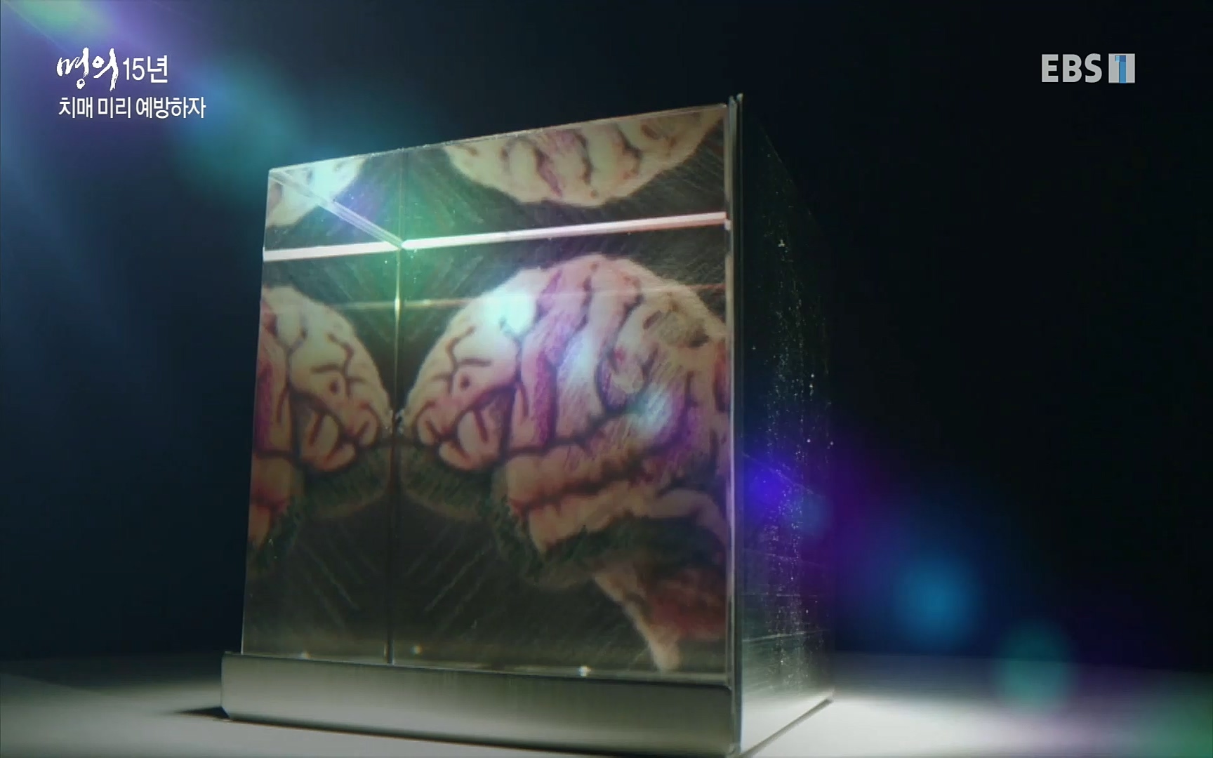 EBS 명의 헬스케어 - TV - 교육의 중심 EBS명의 15년 치매 치료의 패러다임이 바뀐다.mp4_20220808_211013.946.jpg