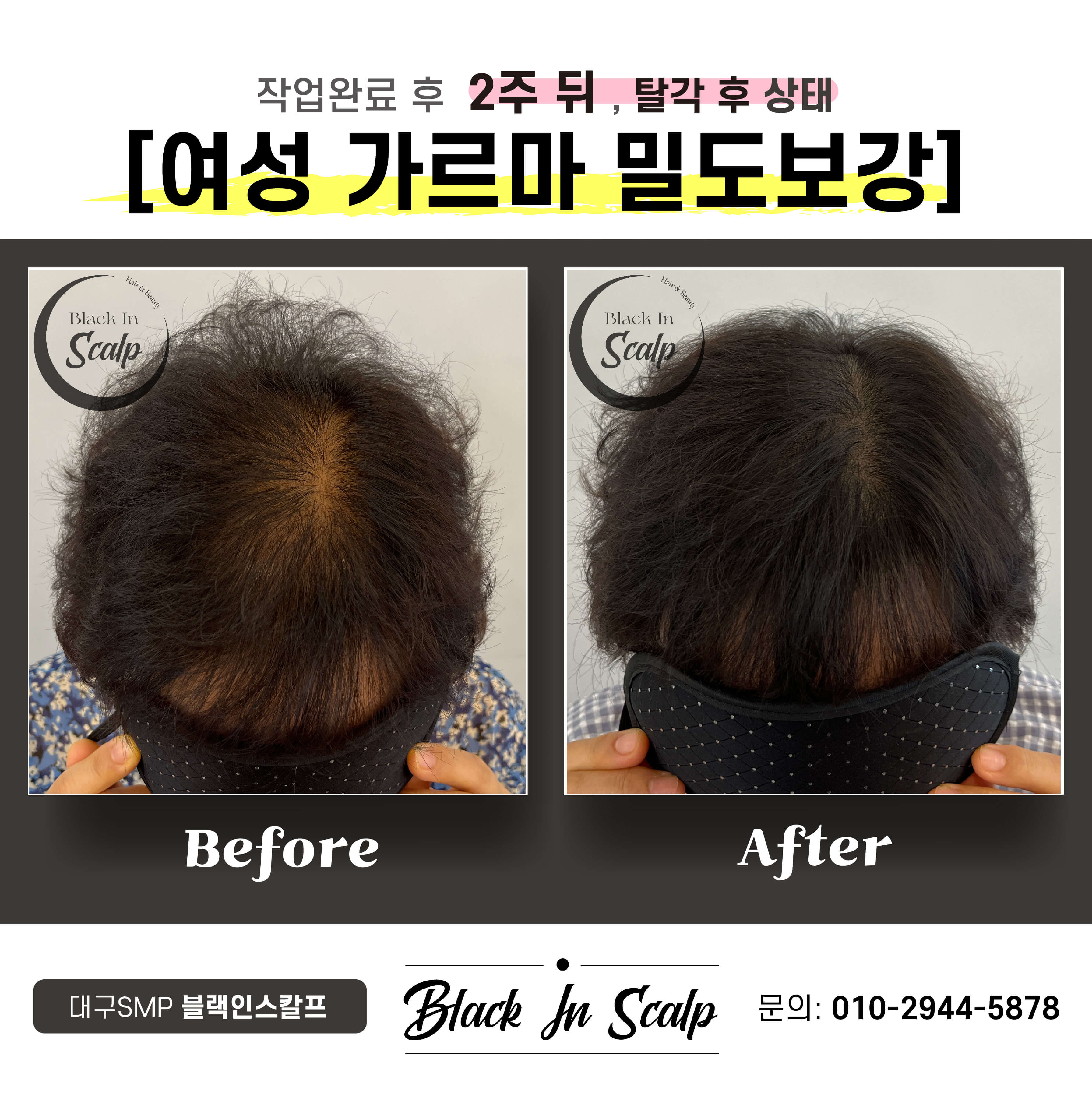블랙인스칼프 이미지