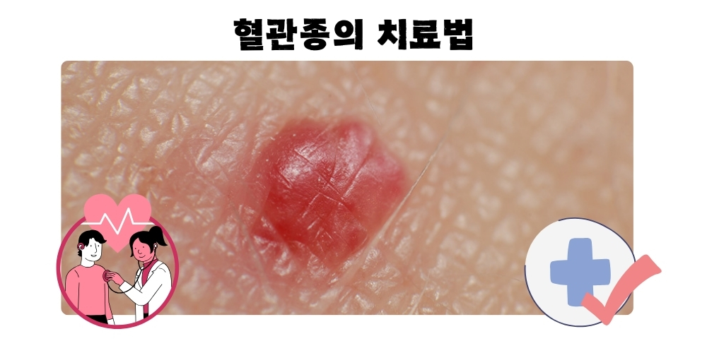 혈관종10