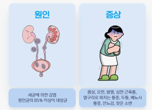 신우신염의 원인(좌)과 증상(우)에 대한 그림