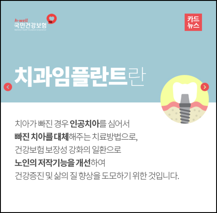 임플란트 보험의 적용 연령이 걱정되는 분들에게