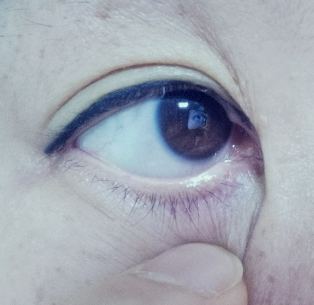 안구건조증 눈이 뻑뻑 침침 깜박이는 습관 예방된다