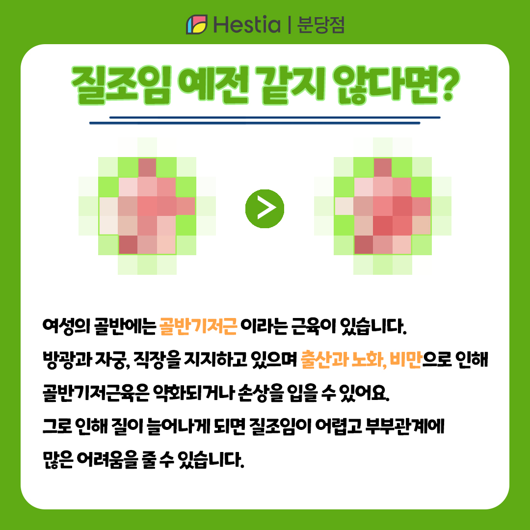 질조임 질수축방법 질시술 질수술 질조임 어려워졌어요...