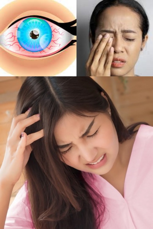 왼쪽 뒤통수의 심한 두통을 어떻게 극복하는지 7