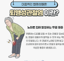 콘드로이친 복용의 장단점