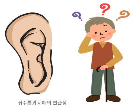  치매 귀주름 생긴다면?