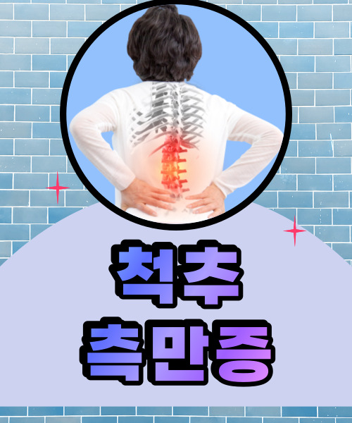  성인보다 청소년기에 더 조심해야하는 척추측만증
