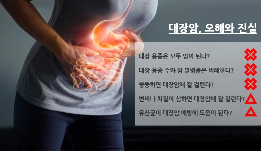 대장암 사진