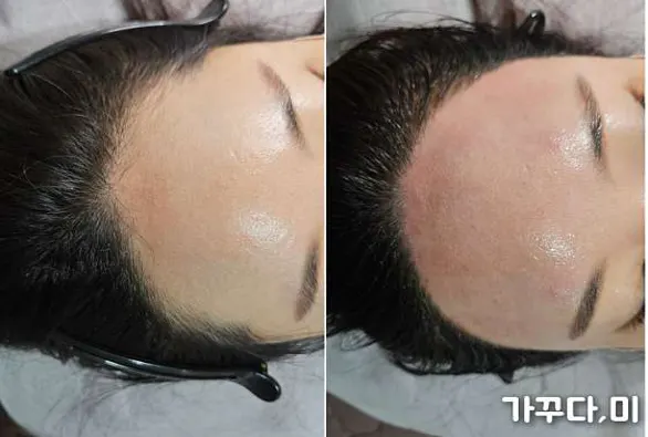 가꾸다,미 왁싱
