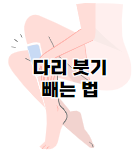 족저근막염 증상 및 치료법과 스트레칭 방법