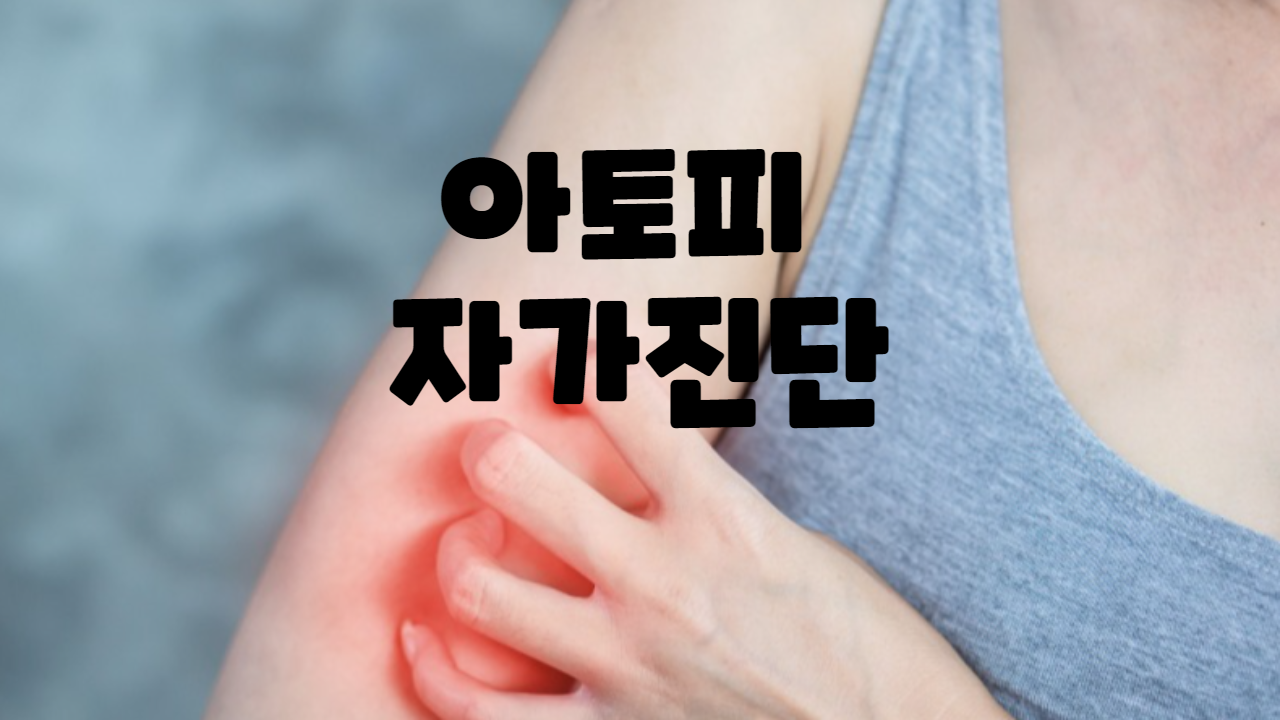  아토피 자가 진단