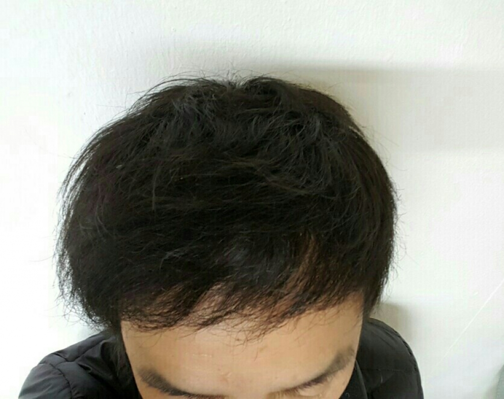 My Image