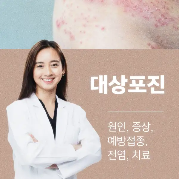 대상포진 원인, 증상, 예방접종, 전염, 치료