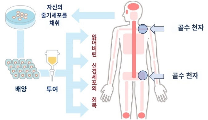 줄기세포의 역할과 최신 연구동향