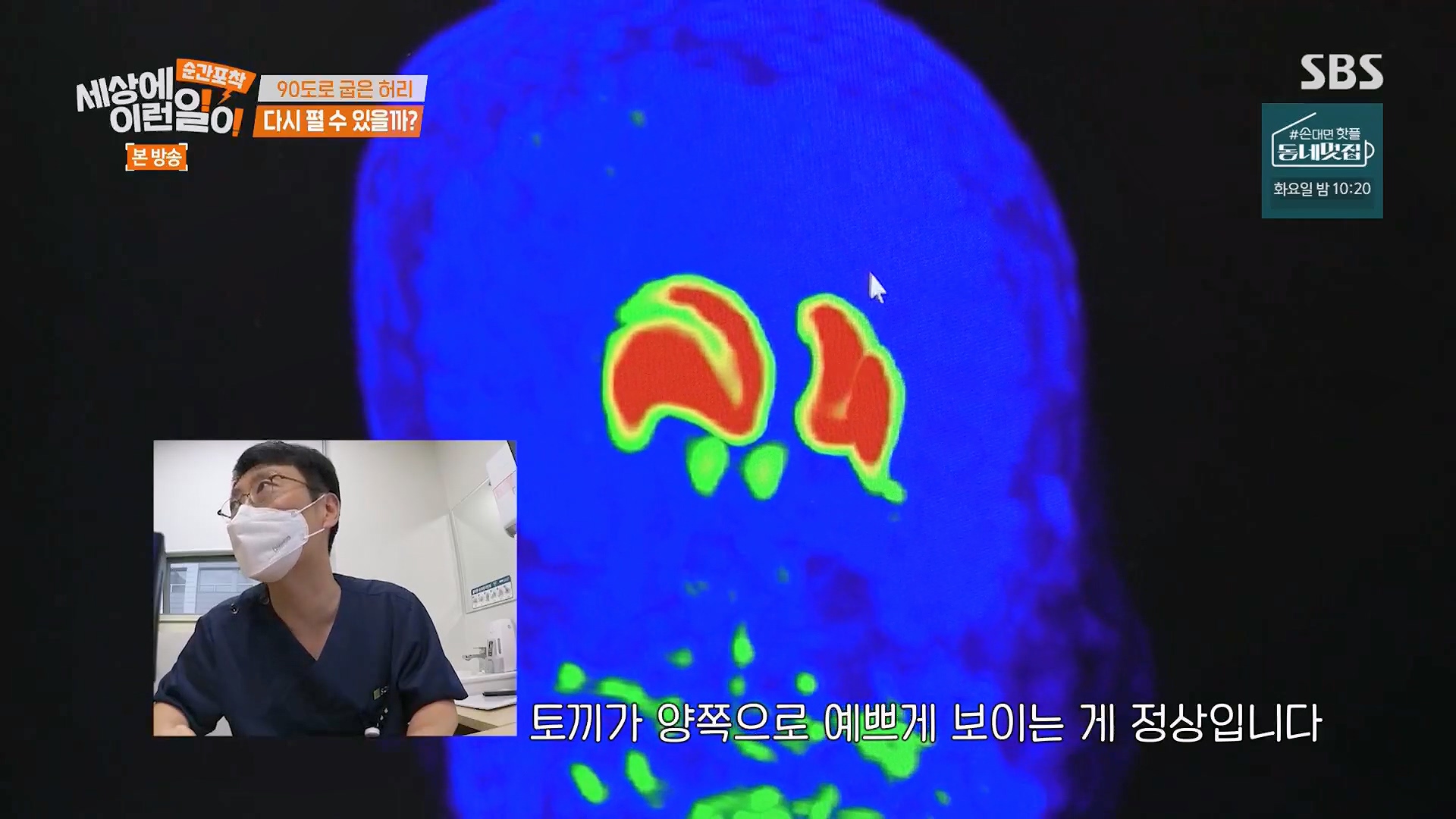 순간포착 세상에 이런일이.E1245.230909p.H264-F1RST.mp4_20230910_165444.247.jpg