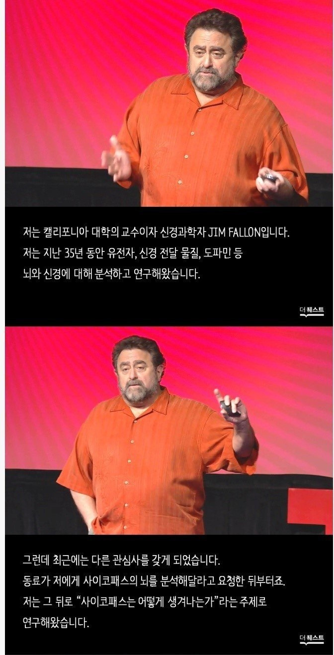 소름 돋는다는 싸이ㅋ패스의 뇌…