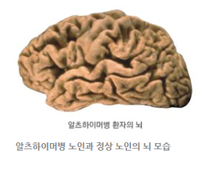  배우 윤정희 청원 / 윤정희 치매 / 백건우 피아니스트