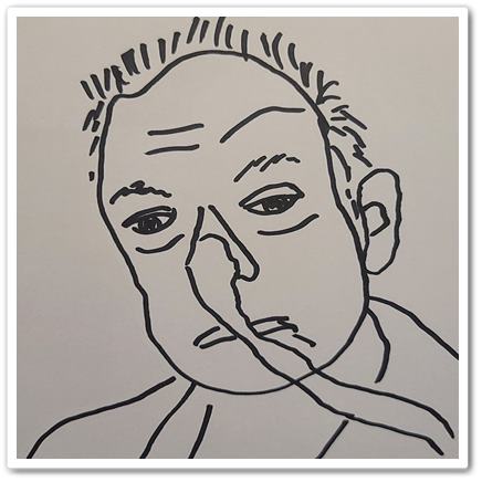  돼지 심장 흉악범, 이식받을 권리
