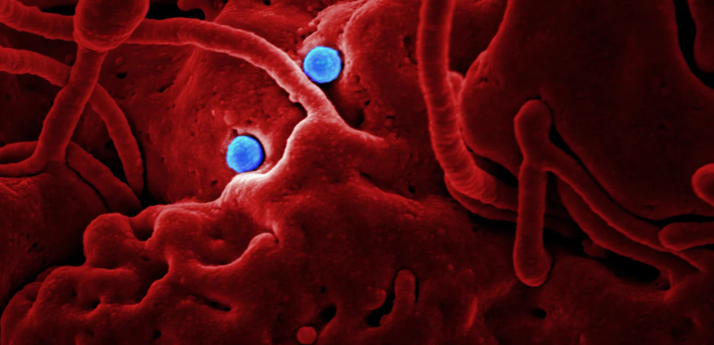  한타바이러스란 무엇일까? Hantaan Virus