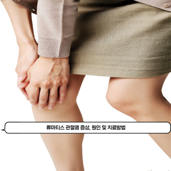  관절 통증이 지속된다면 류마티스 관절염일 수 있습니다. 류마티스 관절염 증상, 원인 및 치료방법