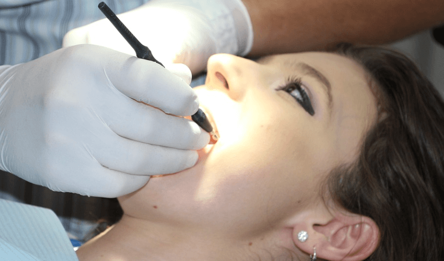 편도결석 제거법으로 치과 치료