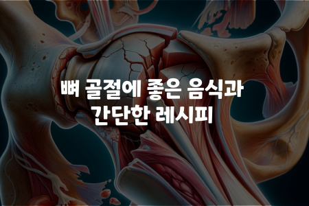 뼈 골절에 좋은 음식